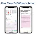 Monitor ecg portátil oled bluetooth ekg cardíaco monitoramento cardíaco wearable eletrocardiograma armazenamento de dados ilimitado compartilhar